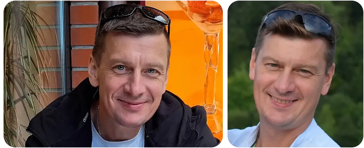 Rak urotelialny z przerzutami do kości❗Bogdan walczy z chorobą❗