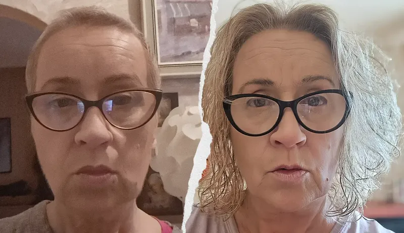 POMÓŻCIE❗Rak szyjki macicy❗Katarzyna walczy o życie❗