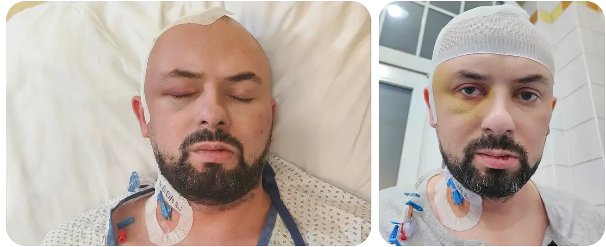 Złośliwy guz mózgu❗POMÓŻ❗Martin chce żyć❗