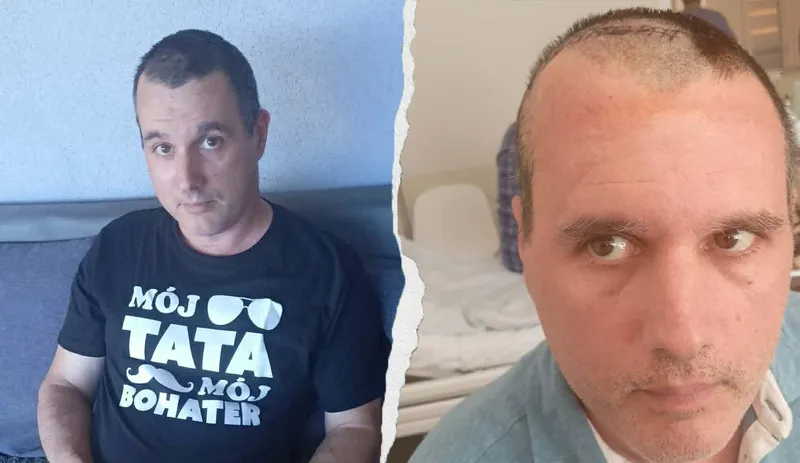 Glejak! Michał potrzebuje wsparcia w powrocie do zdrowia!