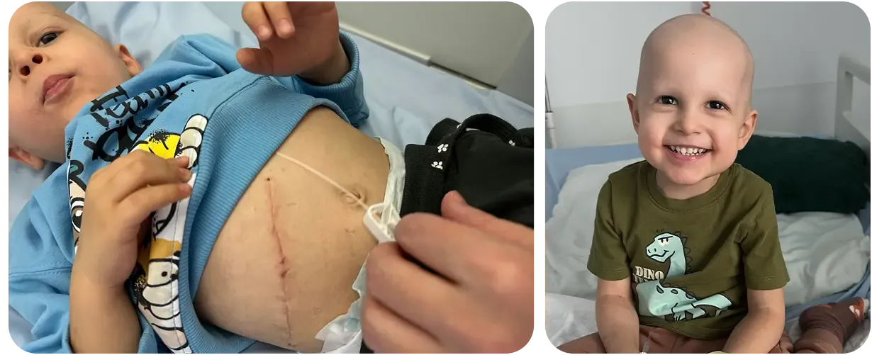 Staś walczy z neuroblastomą IV stopnia❗Potrzebna pomoc❗